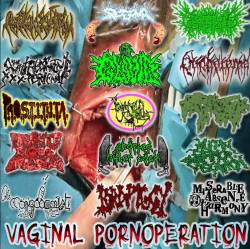 Vaginal Pornoperation